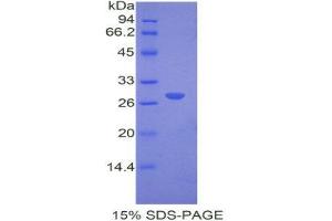 SDS-PAGE (SDS) image for Catechol-O-Methyltransferase (COMT) (AA 63-265) protein (His tag) (ABIN1877759)
