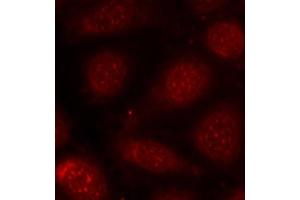 Immunofluorescence analysis of methanol-fixed MCF-7 cells using Phospho-PRKCB-T641 antibody (ABIN3019760, ABIN3019761, ABIN3019762, ABIN1681948 and ABIN1681949).