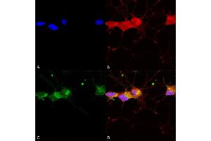 Immunocytochemistry/Immunofluorescence analysis using Mouse Anti-GluN2B/NR2B Monoclonal Antibody, Clone S59-36 (ABIN2483206).