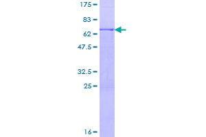 Image no. 1 for Activin A Receptor, Type IIB (ACVR2B) (AA 1-303) protein (GST tag) (ABIN1305815)