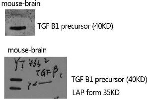 Western Blotting (WB) image for anti-Transforming Growth Factor, beta 1 (TGFB1) (C-Term) antibody (ABIN3187249) (TGFB1 anticorps  (C-Term))