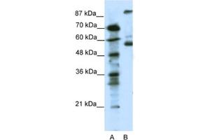 Western Blotting (WB) image for anti-5-Hydroxytryptamine (serotonin) Receptor 7 (Adenylate Cyclase-Coupled) (HTR7) antibody (ABIN2463754) (HTR7 anticorps)