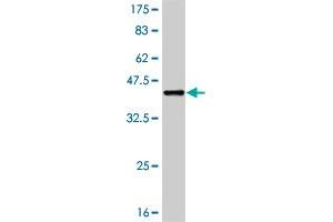 Western Blot detection against Immunogen (37. (RIPK2 anticorps  (AA 431-540))