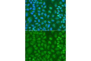 Immunofluorescence analysis of HeLa cell using CXXC1 antibody.