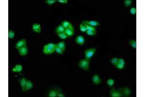 Immunofluorescence staining of HepG2 cells with ABIN7147514 at 1:66, counter-stained with DAPI.
