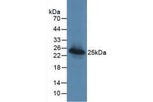 Western Blot; Sample: Recombinant LGALS3BP, Human. (LGALS3BP anticorps  (AA 24-221))