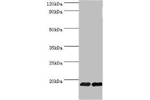 Western blot All lanes: Fibroblast growth factor 1 antibody at 6 μg/mL Lane 1: Mouse kidney tissue Lane 2: Mouse heart tissue Secondary Goat polyclonal to rabbit IgG at 1/10000 dilution Predicted band size: 18, 7 kDa Observed band size: 18 kDa (FGF1 anticorps  (AA 16-155))