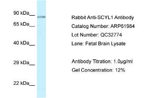 Western Blotting (WB) image for anti-SCY1-Like 1 (SCYL1) (C-Term) antibody (ABIN2788975) (SCYL1 anticorps  (C-Term))