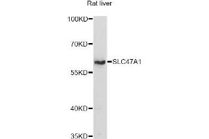 Western blot analysis of extracts of rat liver, using SLC47A1 antibody (ABIN6292279) at 1:1000 dilution.