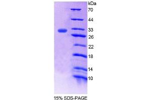 SDS-PAGE (SDS) image for Complement 4 (C4) (AA 126-366) protein (His tag) (ABIN4988550) (Complement C4 Protein (AA 126-366) (His tag))