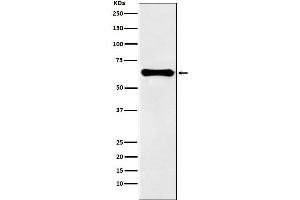 Western blot analysis of Factor IX expression in human plasma lysate.