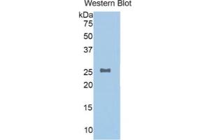 WB of Protein Standard: different control antibodies against Highly purified E. (NAGA Kit ELISA)