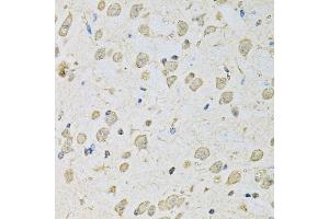 Immunohistochemistry of paraffin-embedded mouse brain using PSMC2 antibody (ABIN5971033) at dilution of 1/100 (40x lens). (PSMC2 anticorps)