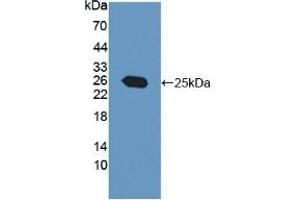 Detection of Recombinant PTP4A3, Human using Polyclonal Antibody to Protein Tyrosine Phosphatase Type IVA 3 (PTP4A3) (PTP4A3 anticorps  (AA 1-170))