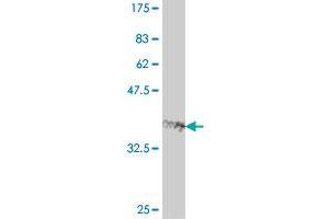 Western Blot detection against Immunogen (38. (FOXQ1 anticorps  (AA 110-219))