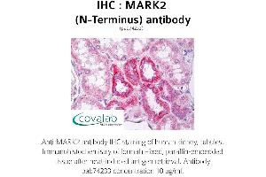 Image no. 1 for anti-MAP/microtubule Affinity-Regulating Kinase 2 (MARK2) antibody (ABIN1736766) (MARK2 anticorps)