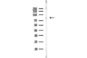 anti-Lysyl Oxidase-Like 2 (LOXL2) (Internal Region) antibody