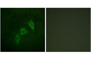 Immunofluorescence analysis of HepG2 cells, using Tuberin/TSC2 (Ab-939) Antibody.