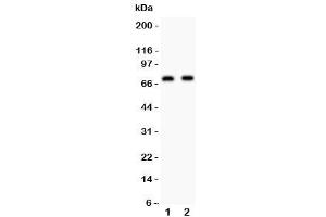 Western blot testing of Numb antibody and Lane 1: human U87 (NUMB anticorps  (AA 194-220))