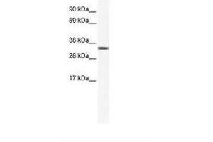 Image no. 1 for anti-Transcription Elongation Factor A Protein 1 (TCEA1) (AA 112-161) antibody (ABIN202195) (TCEA1 anticorps  (AA 112-161))