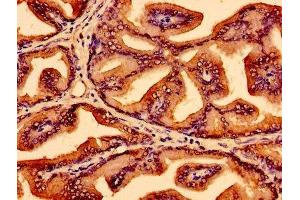 Immunohistochemistry of paraffin-embedded human prostate tissue using ABIN7174184 at dilution of 1:100 (LSM1 anticorps  (AA 1-133))