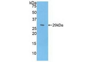 Detection of Recombinant MAT2a, Human using Polyclonal Antibody to Methionine Adenosyltransferase II Alpha (MAT2a) (MAT2A anticorps  (AA 176-395))
