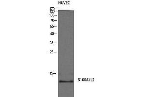 Western Blotting (WB) image for anti-S100 Calcium Binding Protein A7-Like 2 (S100A7L2) (Internal Region) antibody (ABIN3177326) (S100A7L2 anticorps  (Internal Region))