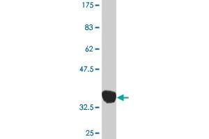 Western Blot detection against Immunogen (36. (MAP2K3 anticorps  (AA 1-100))
