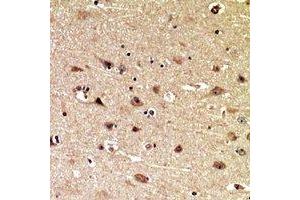 Immunohistochemical analysis of MIB1 staining in human brain formalin fixed paraffin embedded tissue section. (MIB1 anticorps  (C-Term))