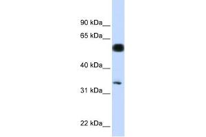 C19ORF62 antibody used at 1 ug/ml to detect target protein. (BRISC and BRCA1 A Complex Member 1 (BABAM1) (N-Term) anticorps)
