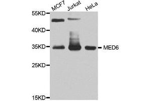Western blot analysis of extracts of various cell lines, using MED6 antibody. (MED6 anticorps  (AA 27-246))