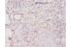 Immunohistochemistry of paraffin-embedded human kidney tissue using ABIN7142715 at dilution of 1:20