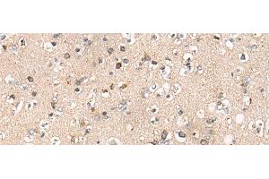 Immunohistochemistry of paraffin-embedded Human brain tissue using C14orf2 Polyclonal Antibody at dilution of 1:60(x200) (C14orf2 anticorps)