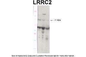 WB Suggested Anti-TP53 Antibody Titration: 0. (LRRC2 anticorps  (N-Term))