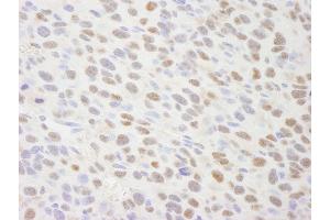 Immunohistochemistry (IHC) image for anti-Tripartite Motif Containing 24 (TRIM24) (AA 700-750) antibody (ABIN7448834) (TRIM24 anticorps  (AA 700-750))