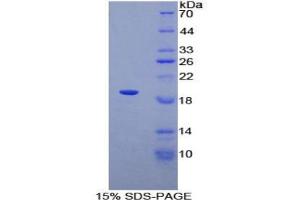 SDS-PAGE analysis of Human ADRA1A Protein. (alpha 1 Adrenergic Receptor Protéine)