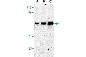 Western blot analysis of EIF2AK2 in A-431 whole cell lysate with EIF2AK2 polyclonal antibody  at (A) 0. (EIF2AK2 anticorps  (C-Term))