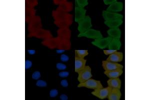 ABIN6261989 and ABIN6269005 staining Hela cells(30 min of UV treatment) by IF/ICC. (Metabotropic Glutamate Receptor 4 anticorps  (C-Term))