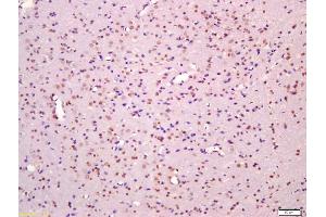 anti-Mitogen-Activated Protein Kinase-Activated Protein Kinase 2 (MAPKAPK2) (pThr334) antibody