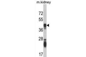 Western Blotting (WB) image for anti-Argininosuccinate Synthase 1 (ASS1) antibody (ABIN3002823) (ASS1 anticorps)