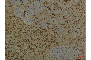 Immunohistochemistry (IHC) analysis of paraffin-embedded Mouse Brain Tissue using HIF-1 beta/ARNT Mouse Monoclonal Antibody diluted at 1:200. (ARNT anticorps)