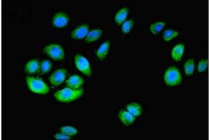Immunofluorescent analysis of A549 cells using ABIN7149376 at dilution of 1:100 and Alexa Fluor 488-congugated AffiniPure Goat Anti-Rabbit IgG(H+L) (NT5C1A anticorps  (AA 1-368))