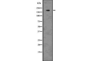 Western blot analysis of BRG1 using 293 whole cell lysates (SMARCA4 anticorps  (N-Term))