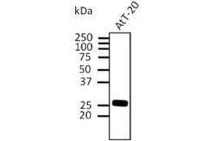 RAB3A anticorps  (C-Term)