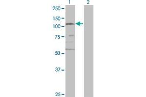 Western Blot analysis of SMC3 expression in transfected 293T cell line by CSPG6 monoclonal antibody (M02), clone 2F11. (SMC3 anticorps  (AA 711-810))