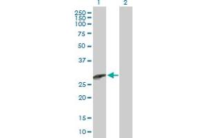 Western Blot analysis of CCBE1 expression in transfected 293T cell line by CCBE1 MaxPab polyclonal antibody. (CCBE1 anticorps  (AA 1-215))