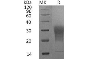 Western Blotting (WB) image for Leukocyte-Associated Immunoglobulin-Like Receptor 1 (LAIR1) (AA 22-141) protein (His tag) (ABIN7320604)