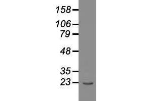 Western blot analysis of 35 µg of cell extracts from human Liver carcinoma (HepG2) cells using anti-AK1 antibody. (Adenylate Kinase 1 anticorps)