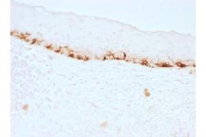 IHC testing of FFPE human skin stained with MART-1 antibody (clone M2-7C10). (MLANA anticorps)