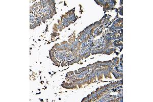 IHC analysis of MVP using anti-MVP antibody (ABIN7600481).